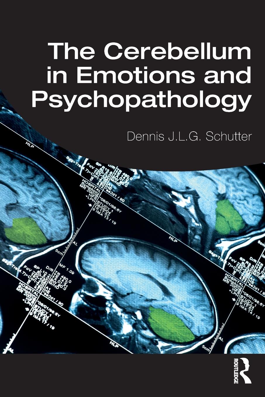 Cover: 9781138502802 | The Cerebellum in Emotions and Psychopathology | Schutter | Buch