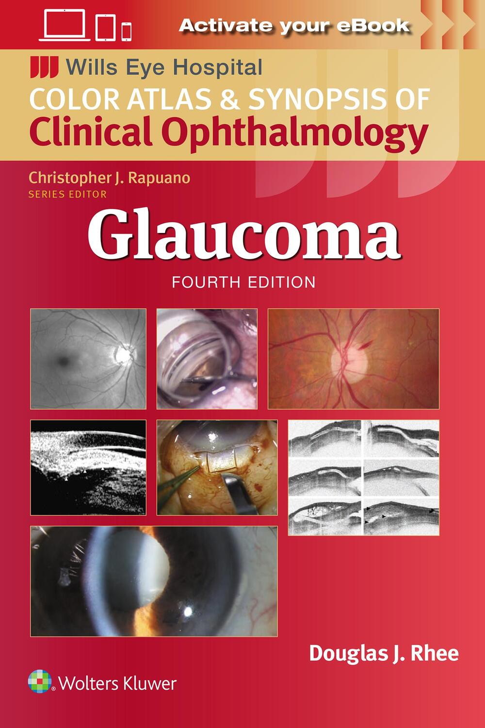 Cover: 9781975214814 | Glaucoma | Douglas J Rhee | Taschenbuch | Englisch | 2024