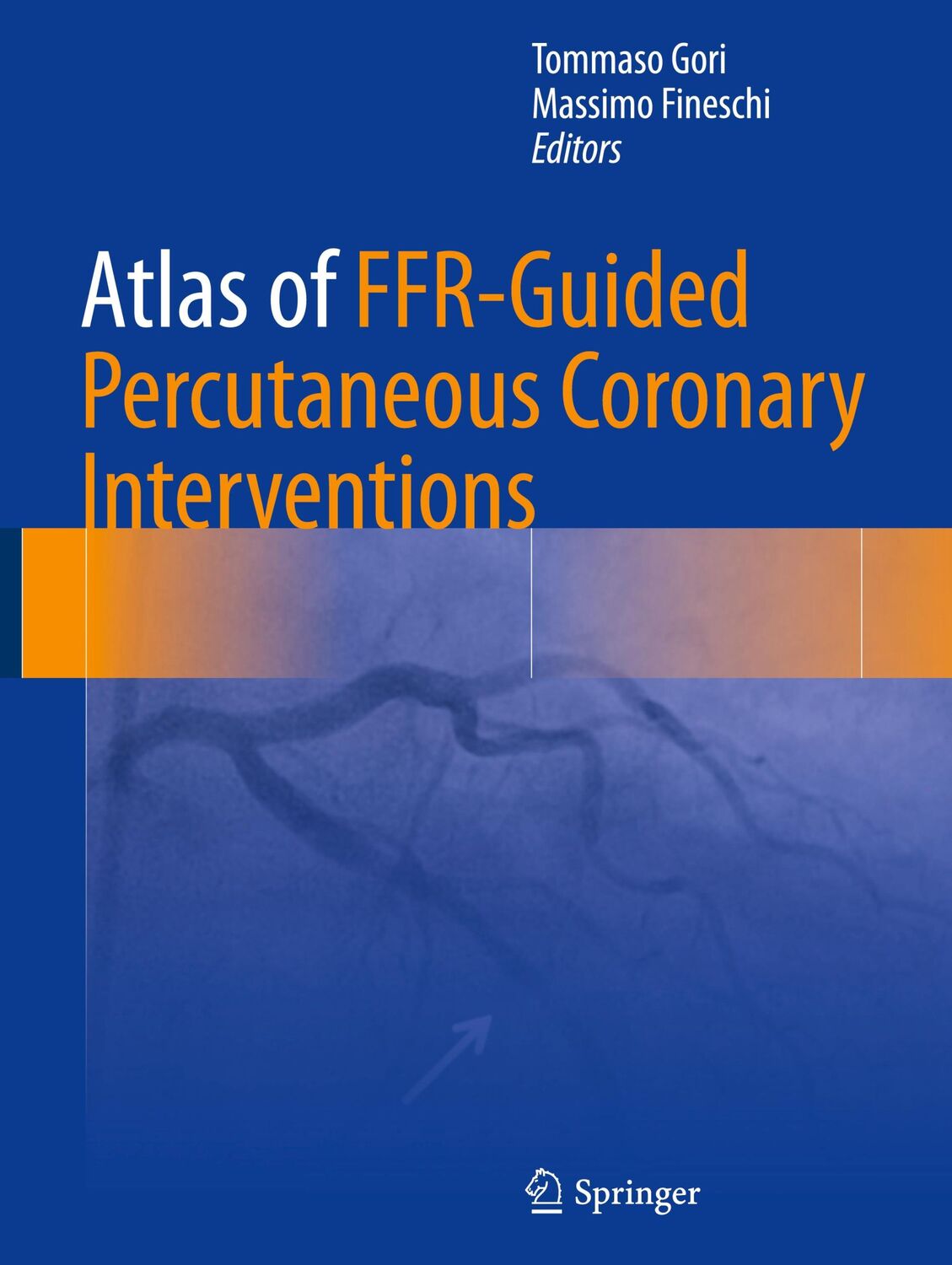 Cover: 9783319471143 | Atlas of FFR-Guided Percutaneous Coronary Interventions | Buch | xvi