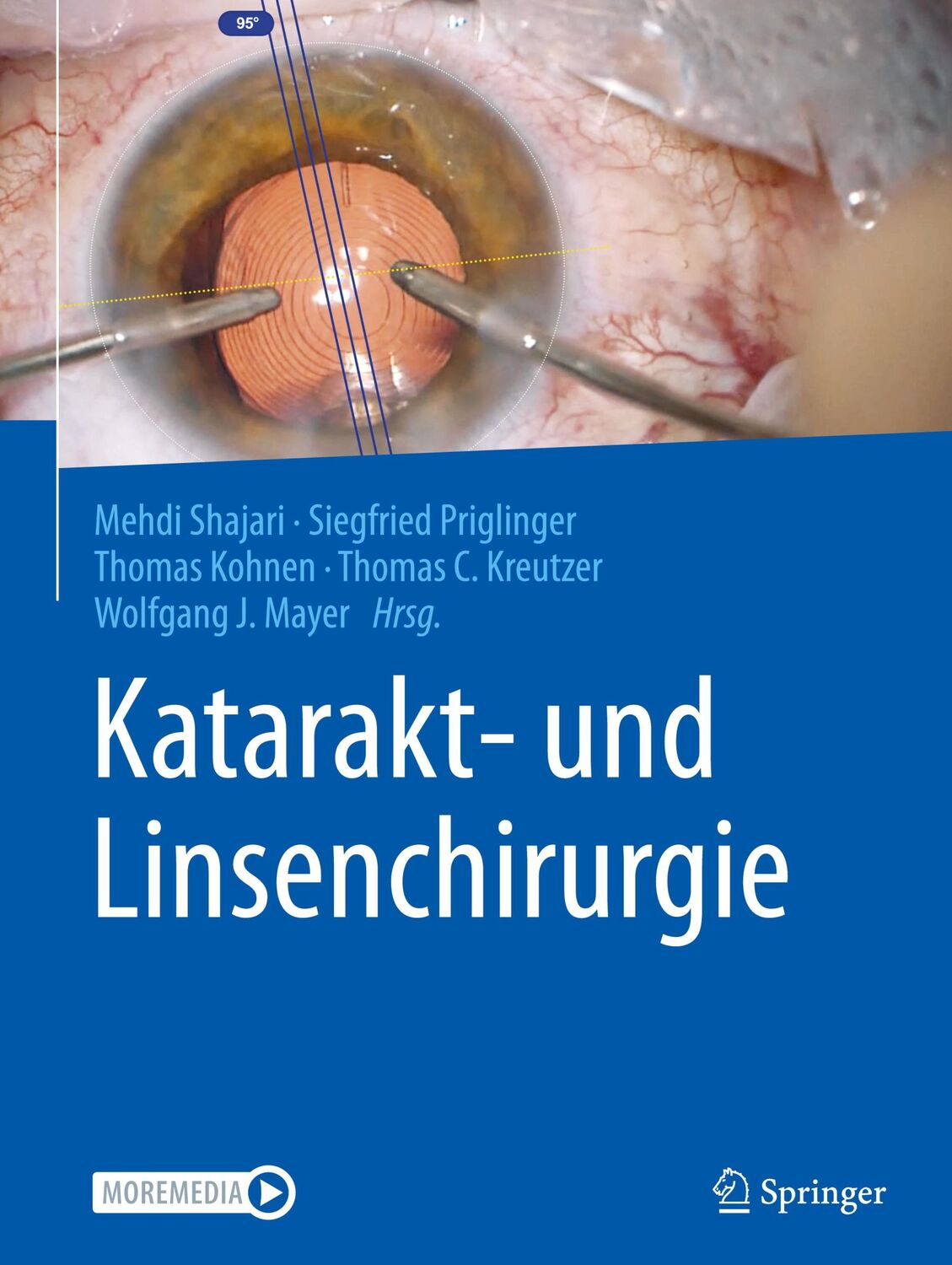 Cover: 9783662624579 | Katarakt- und Linsenchirurgie | Mehdi Shajari (u. a.) | Buch | XVI