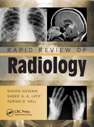 Cover: 9781840761207 | Rapid Review of Radiology | Adrian David Hall (u. a.) | Taschenbuch