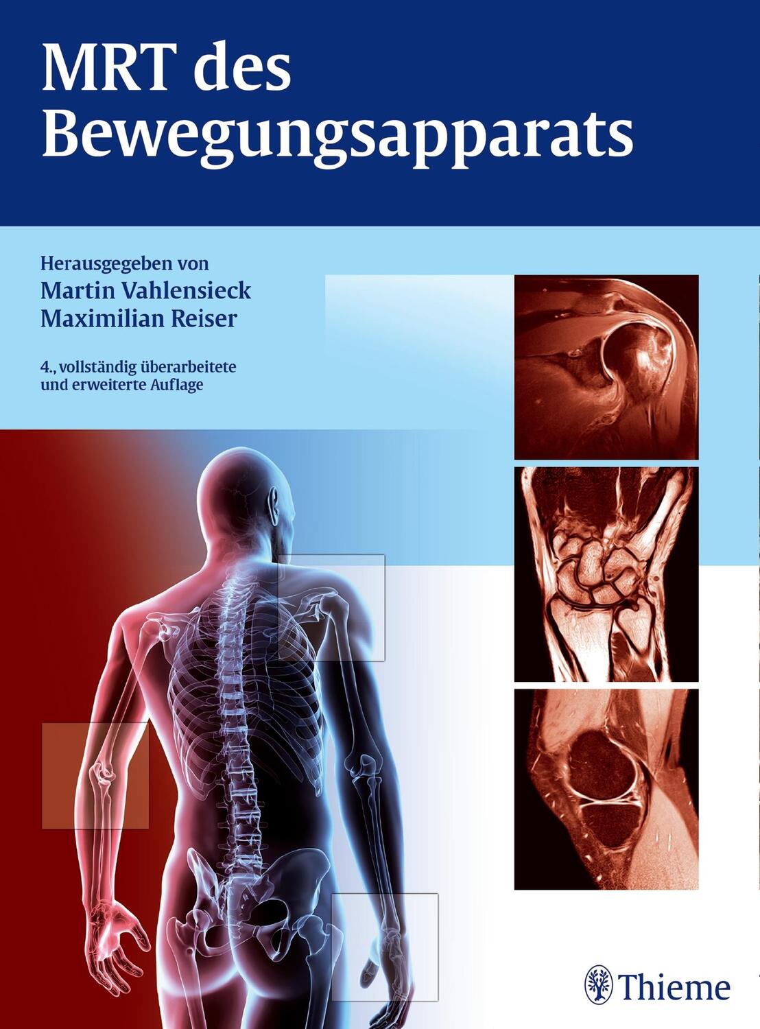 Cover: 9783131036841 | MRT des Bewegungsapparats | Martin Vahlensieck (u. a.) | Buch | 2014