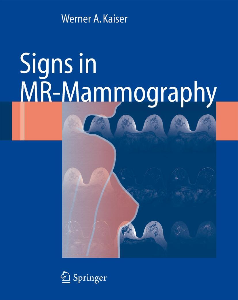 Cover: 9783540732921 | Signs in MR-Mammography | Werner A. Kaiser | Buch | xiv | Englisch