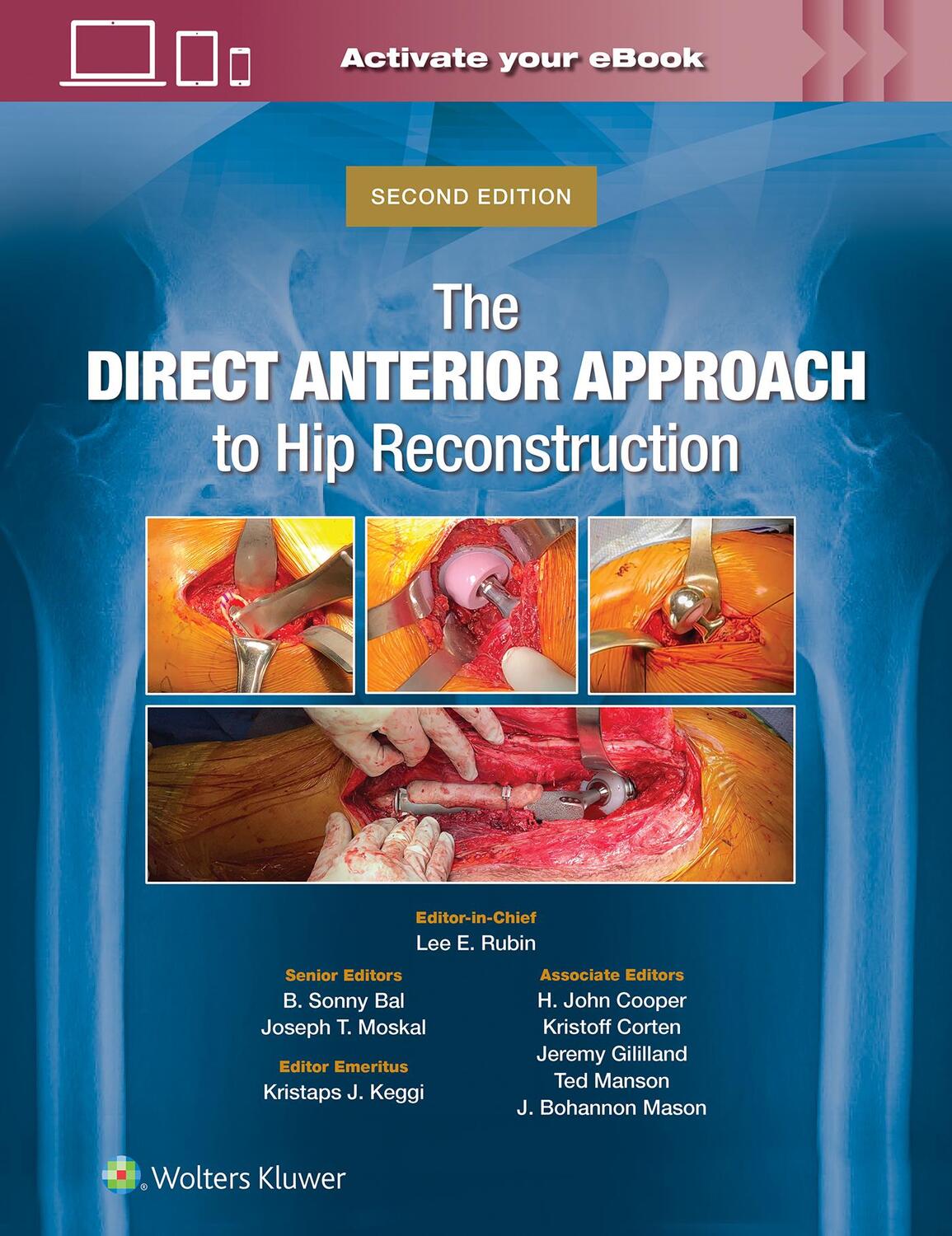 Cover: 9781975221973 | The Direct Anterior Approach to Hip Reconstruction | Bal (u. a.)