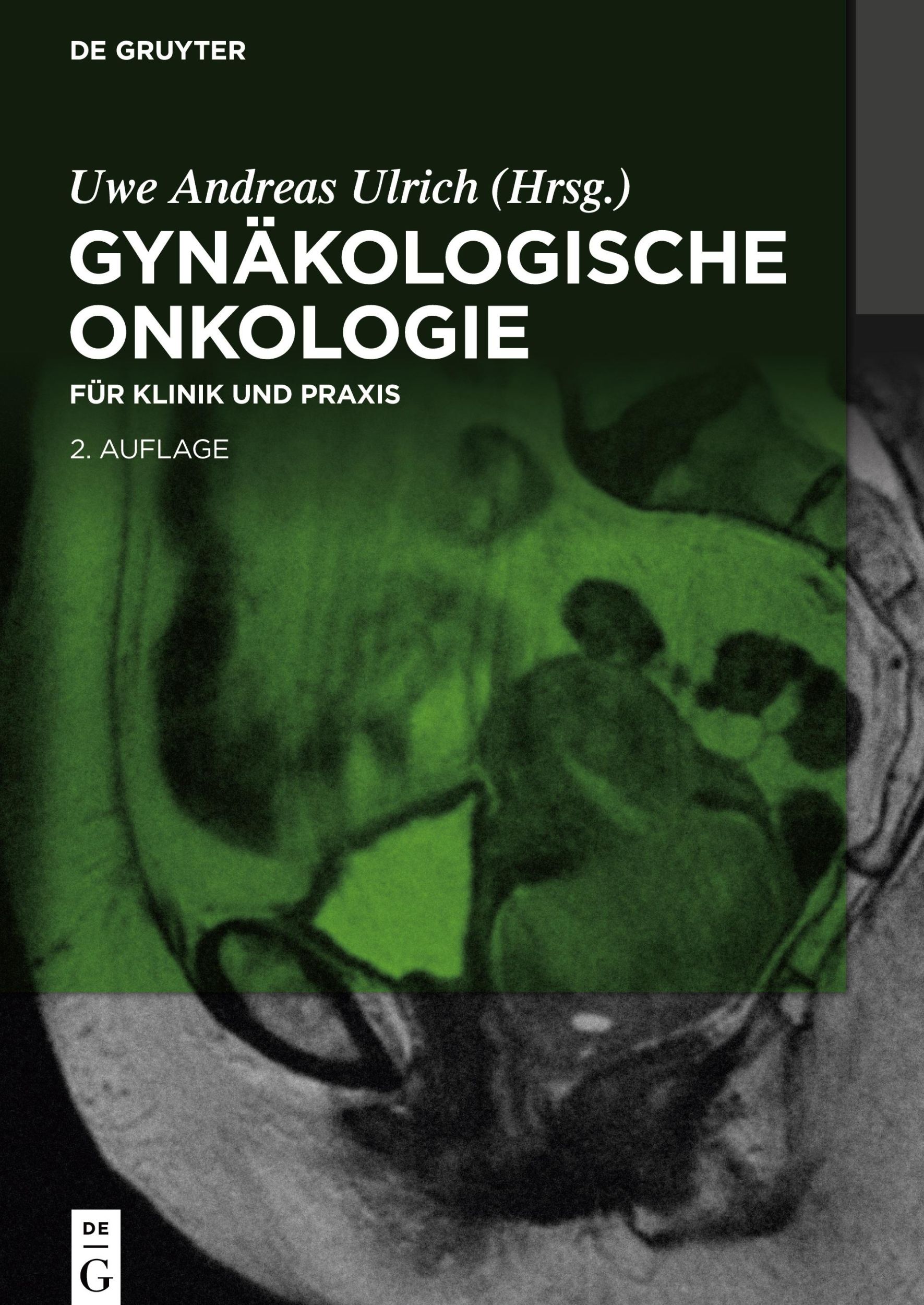 Cover: 9783110612615 | Gynäkologische Onkologie | für Klinik und Praxis | Uwe Andreas Ulrich