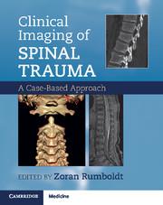 Cover: 9781107427471 | Clinical Imaging of Spinal Trauma | A Case-Based Approach | Buch