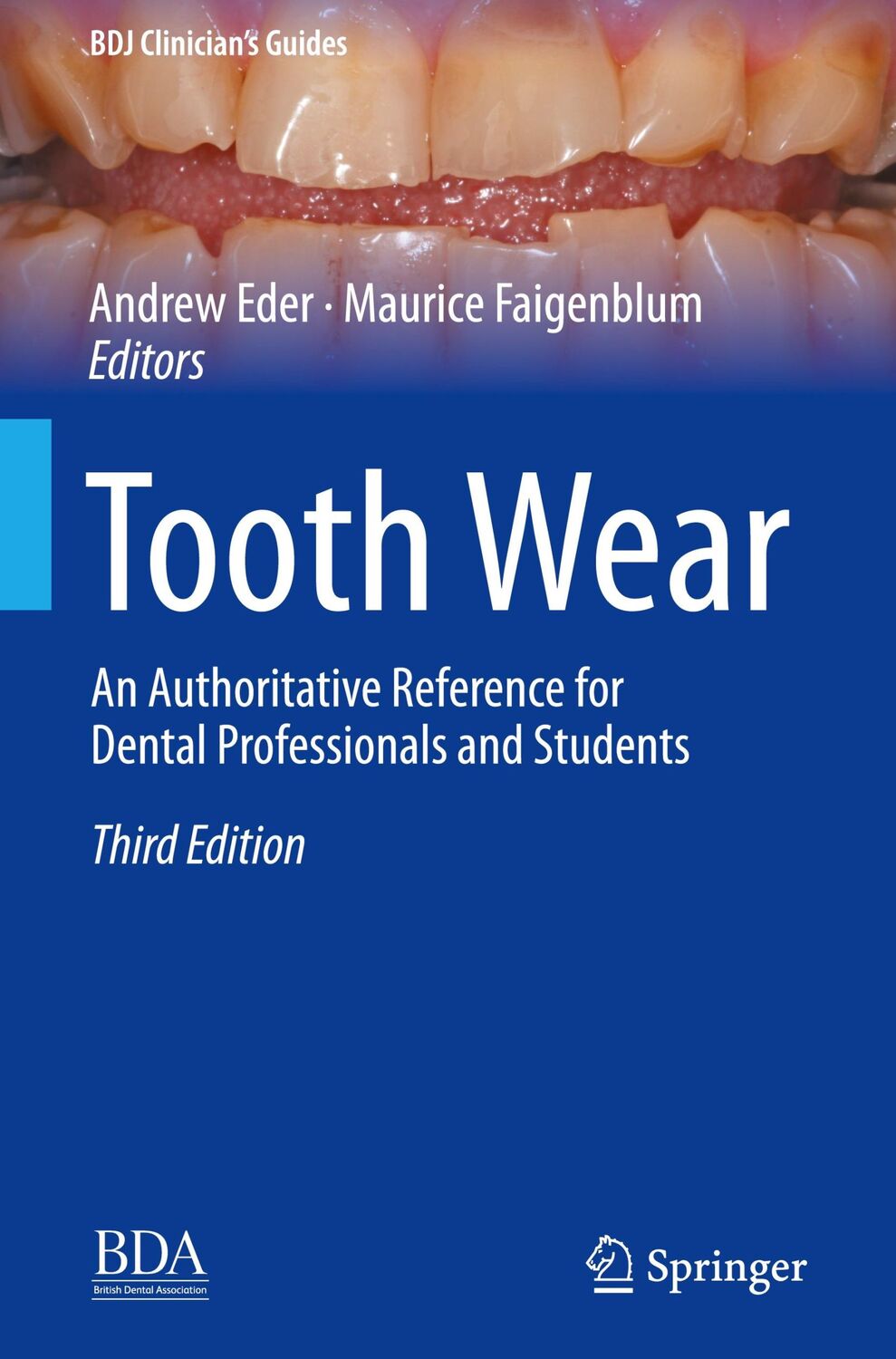 Cover: 9783030861094 | Tooth Wear | Maurice Faigenblum (u. a.) | Buch | xxii | Englisch