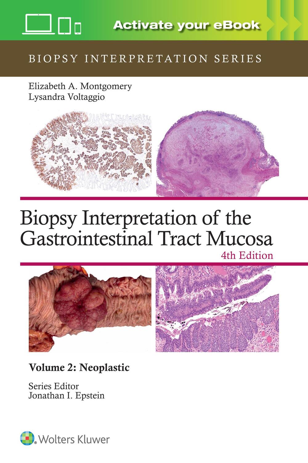 Cover: 9781975213695 | Biopsy Interpretation of the Gastrointestinal Tract Mucosa Volume 2