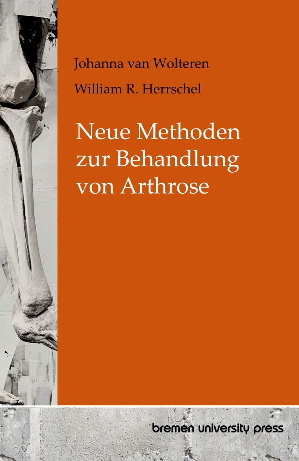 Cover: 9783689049300 | Neue Methoden zur Behandlung von Arthrose | Wolteren (u. a.) | Buch