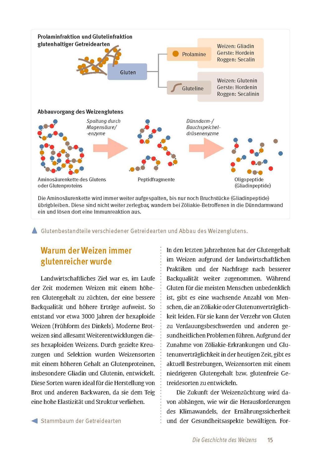 Bild: 9783432117805 | Zöliakie | Markus Escher | Taschenbuch | Broschiert (KB) | 128 S.