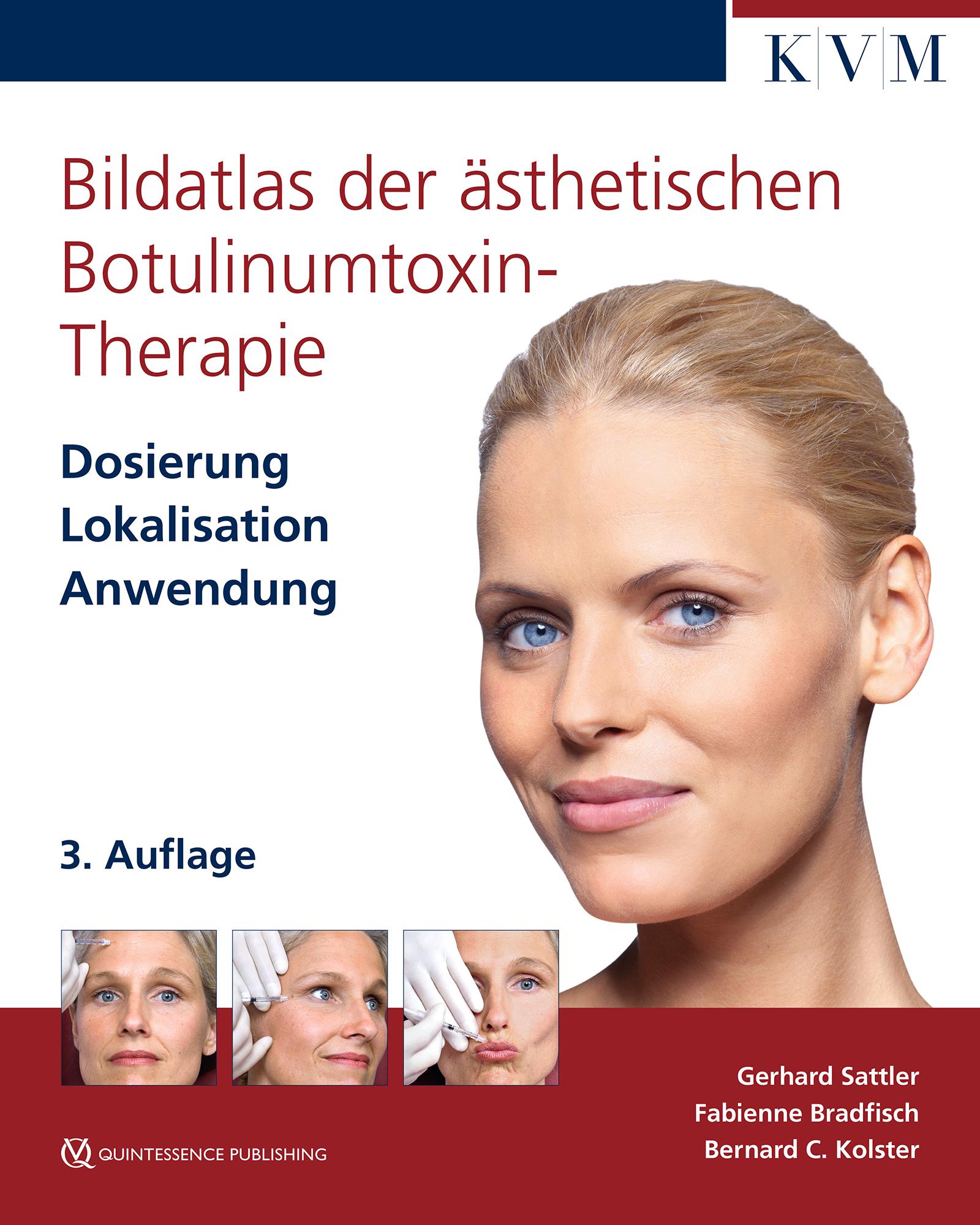 Cover: 9783868677577 | Bildatlas der ästhetischen Botulinumtoxin-Therapie | Bradfisch (u. a.)