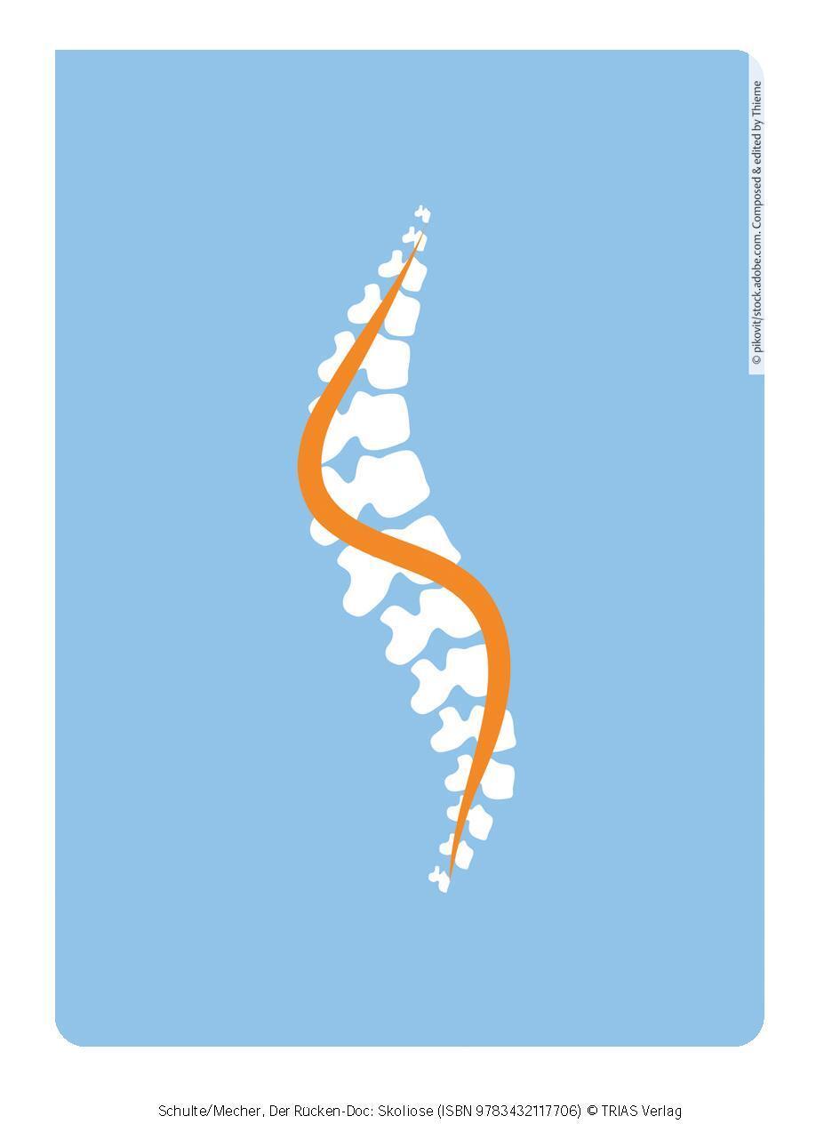 Bild: 9783432117706 | Der Rücken-Doc: Skoliose | Tobias L. Schulte (u. a.) | Taschenbuch