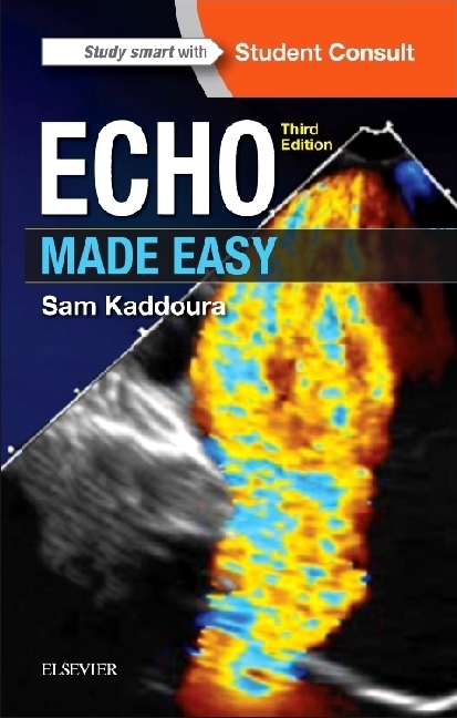 Cover: 9780702066566 | Echo Made Easy | Student Consult | Sam Kaddoura | Taschenbuch | 2016