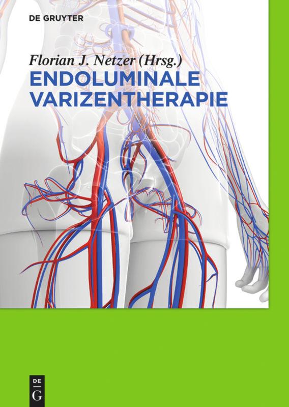 Cover: 9783110352887 | Endoluminale Varizentherapie | Florian Johannes Netzer | Buch | XVI