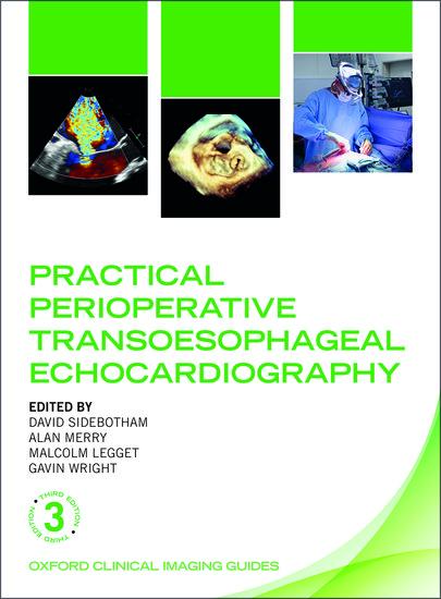 Cover: 9780198759089 | Practical Perioperative Transoesophageal Echocardiography | Buch