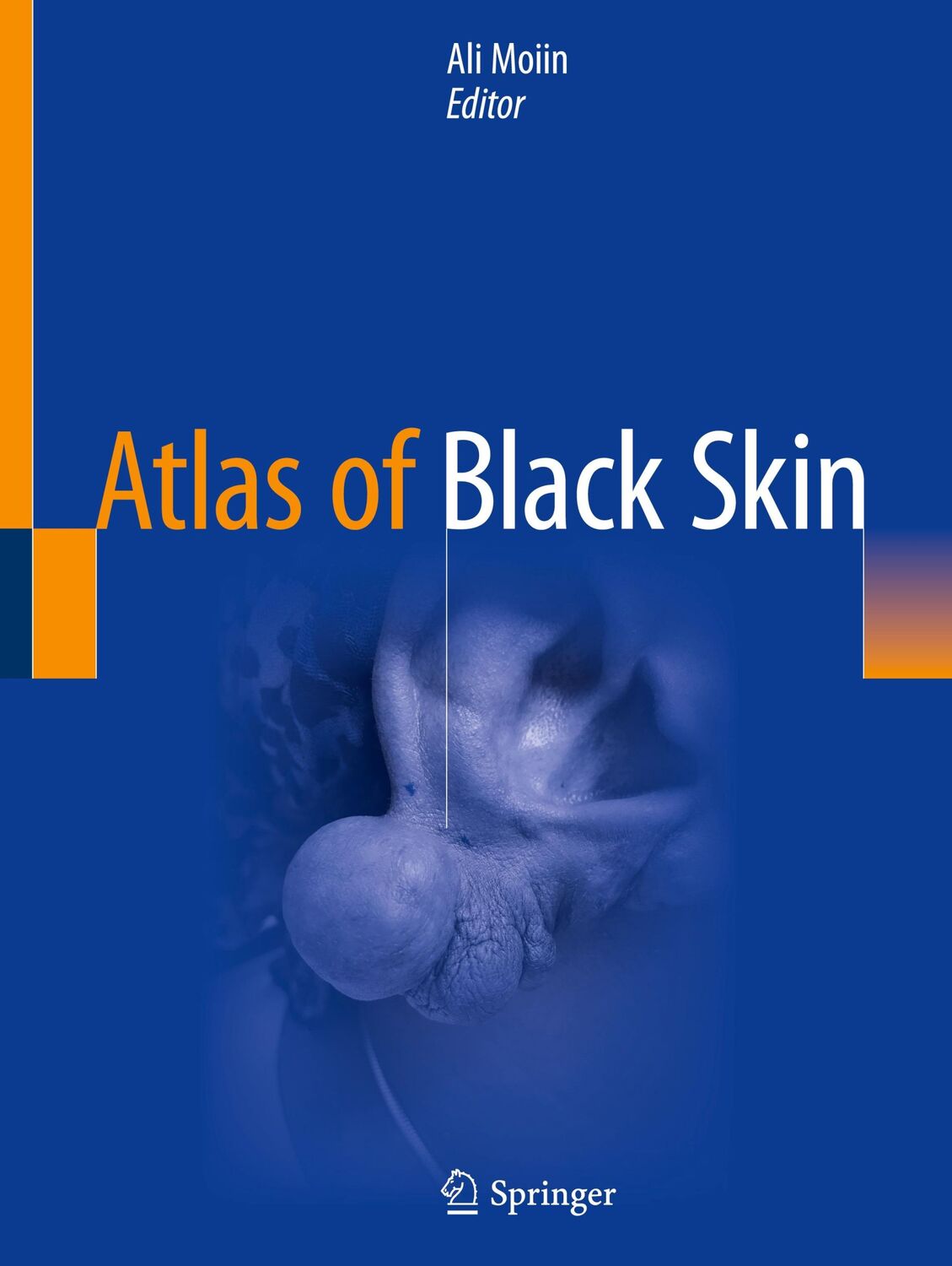 Cover: 9783030314873 | Atlas of Black Skin | Ali Moiin | Taschenbuch | Paperback | xiii