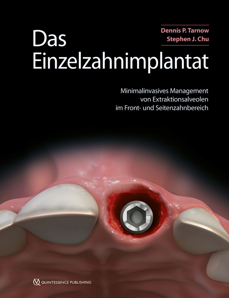 Cover: 9783868675344 | Das Einzelzahnimplantat | Dennis P. Tarnow (u. a.) | Buch | 240 S.