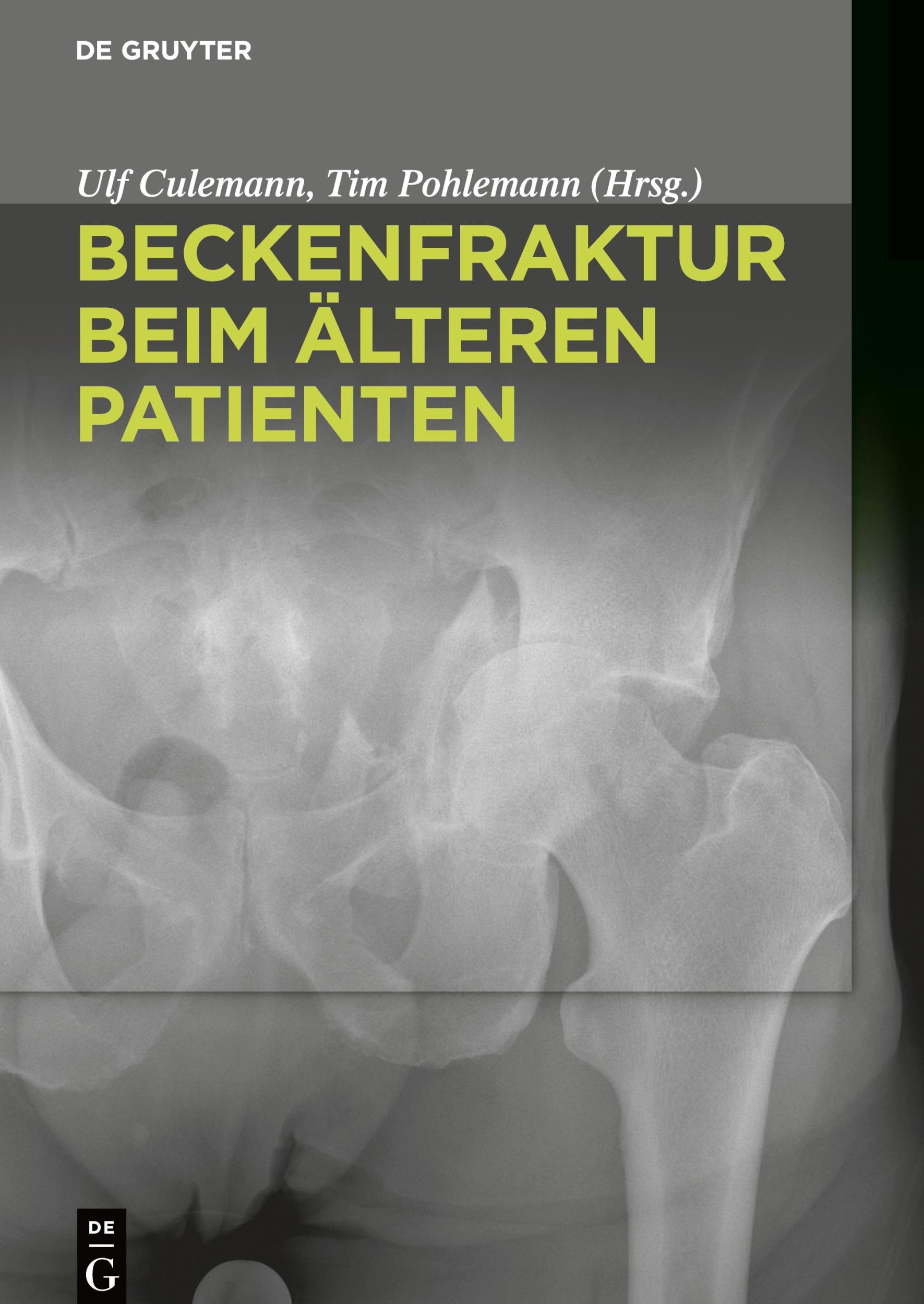 Cover: 9783110426489 | Beckenfraktur beim älteren Patienten | Tim Pohlemann (u. a.) | Buch