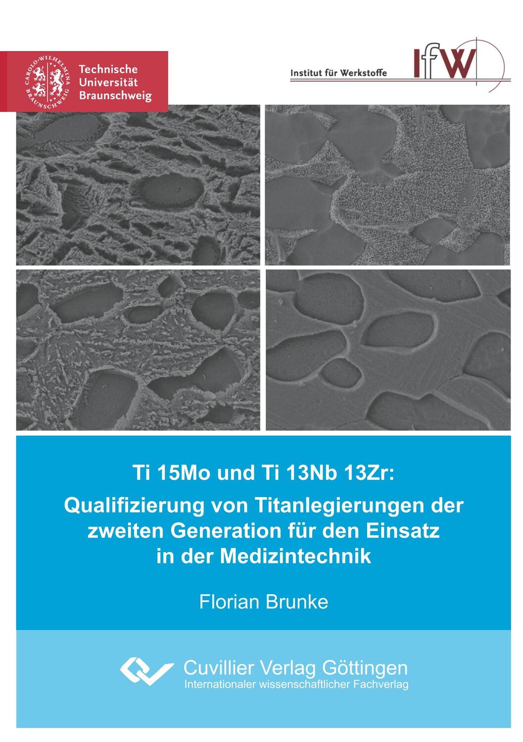 Cover: 9783736970632 | Ti 15Mo und Ti 13Nb 13Zr: Qualifizierung von Titanlegierungen der...