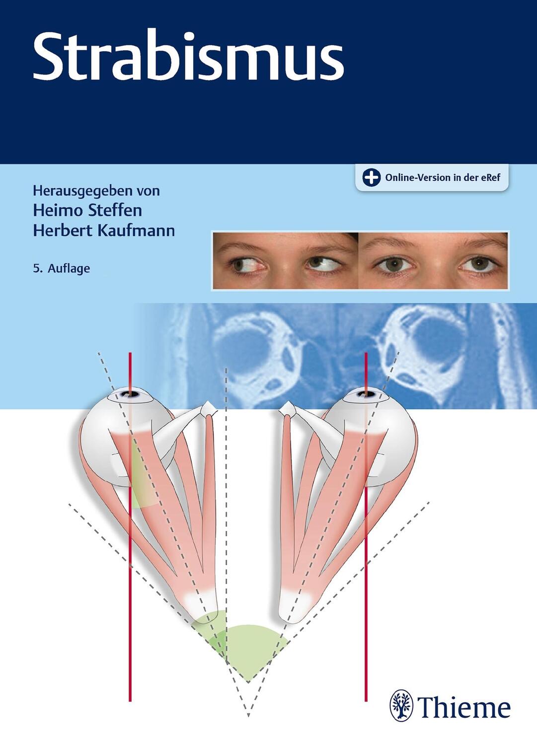 Cover: 9783132413306 | Strabismus | Herbert Kaufmann (u. a.) | Bundle | Mixed Media Product