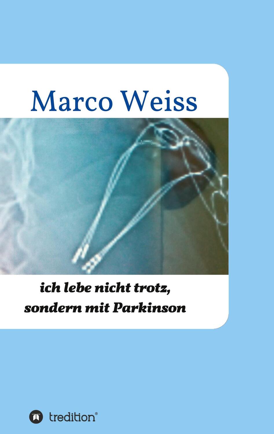 Cover: 9783347343351 | Ich lebe nicht trotz, sondern mit Parkinson | Marco Weiß | Taschenbuch