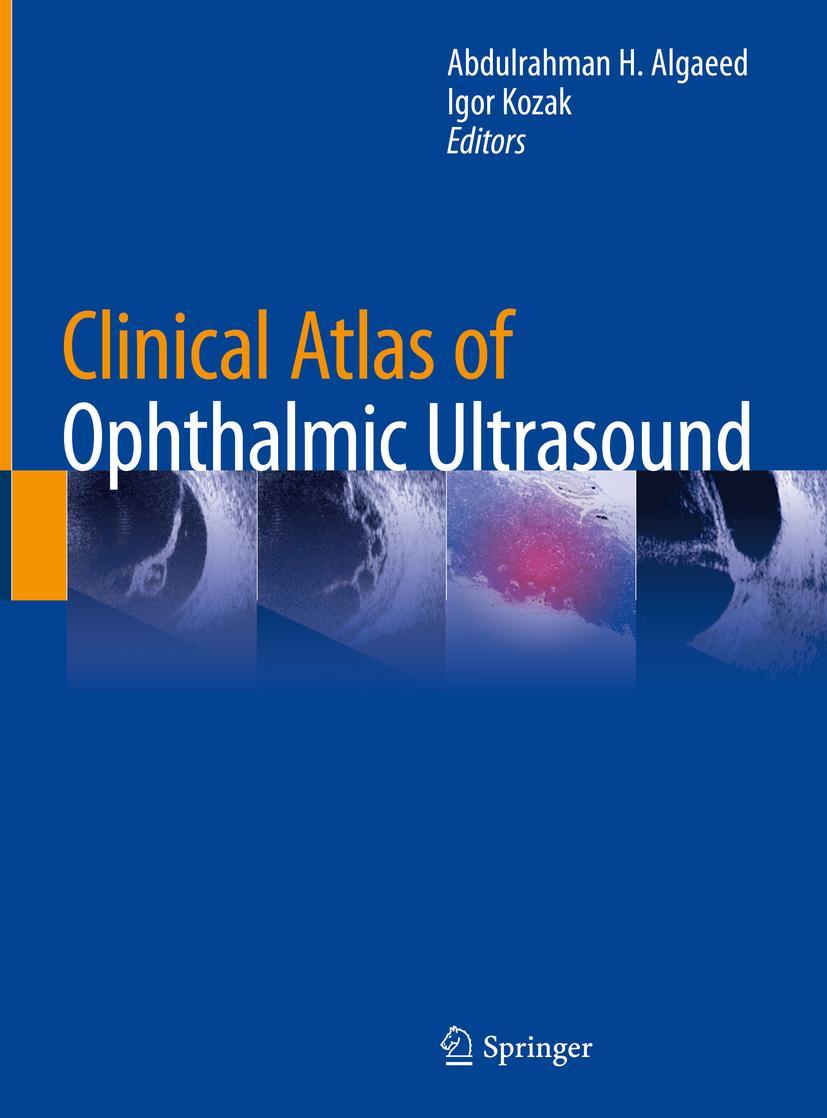 Cover: 9783319998695 | Clinical Atlas of Ophthalmic Ultrasound | Igor Kozak (u. a.) | Buch