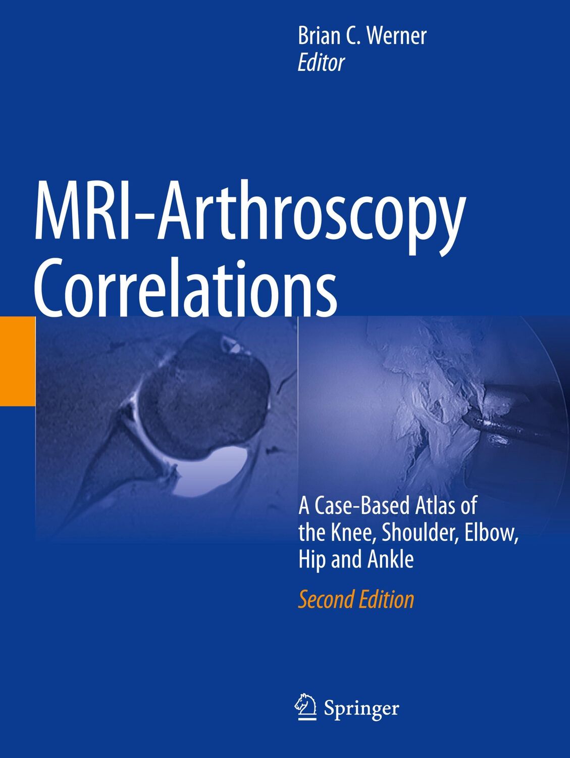 Cover: 9783030947910 | MRI-Arthroscopy Correlations | Brian C. Werner | Taschenbuch | xviii