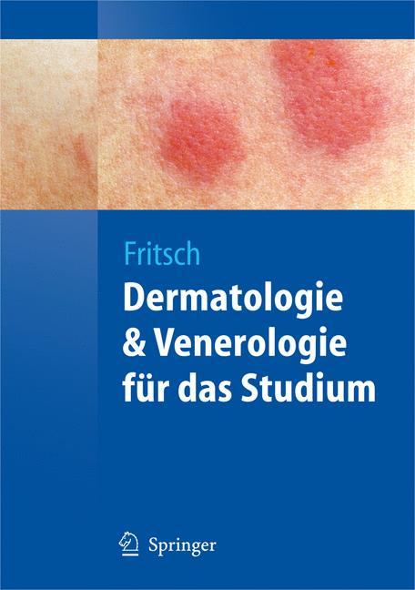 Cover: 9783540793021 | Dermatologie und Venerologie für das Studium | Peter Fritsch | Buch