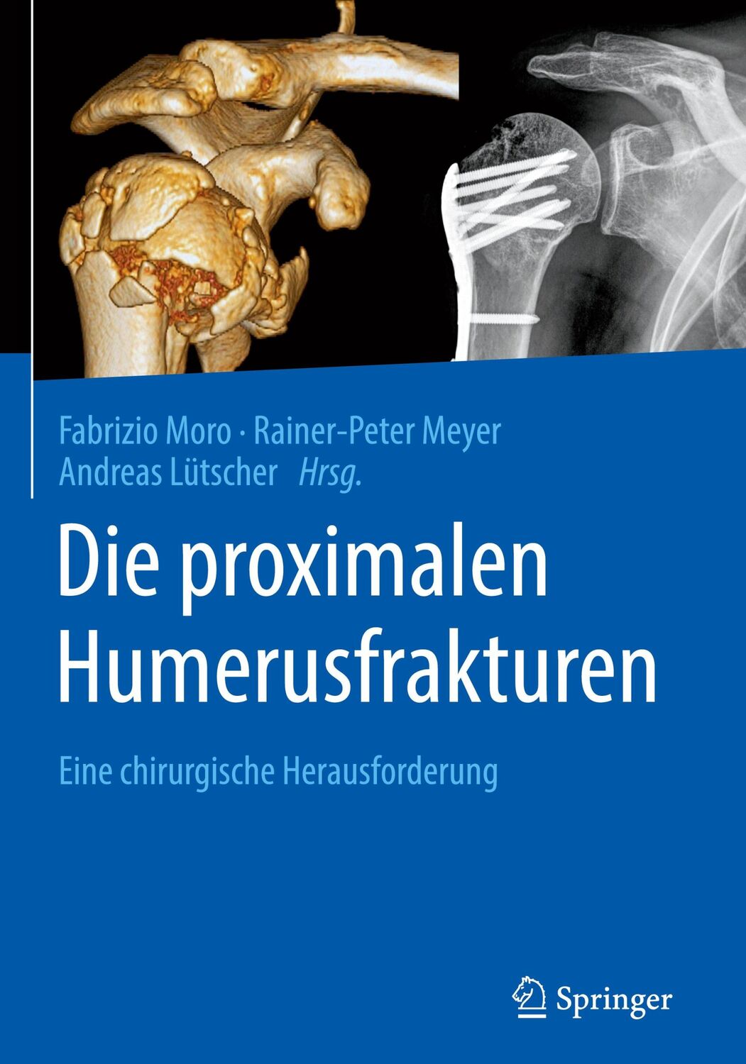 Cover: 9783662608524 | Die proximalen Humerusfrakturen | Eine chirurgische Herausforderung