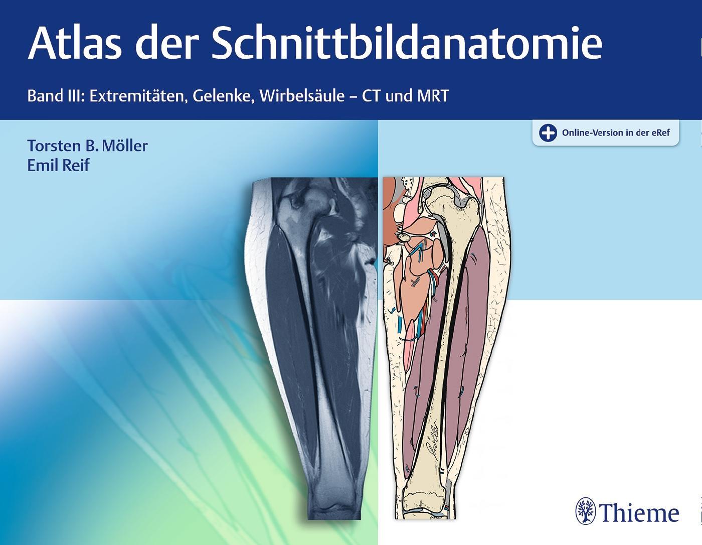 Cover: 9783132032811 | Atlas der Schnittbildanatomie. Band 03 | Torsten Bert Möller (u. a.)