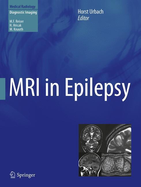 Cover: 9783642251375 | MRI in Epilepsy | Horst Urbach | Buch | Diagnostic Imaging | xiii