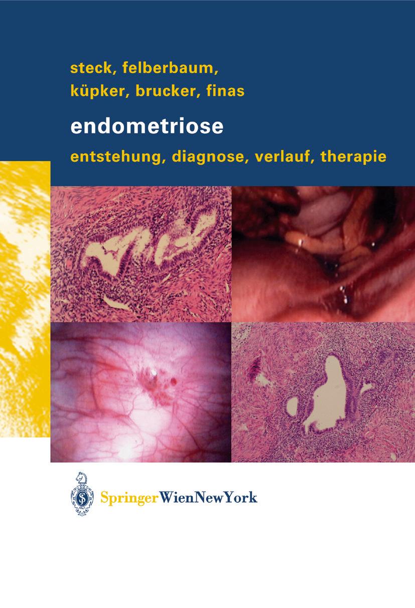 Cover: 9783709171967 | Endometriose | Entstehung, Diagnose, Verlauf und Therapie | Buch