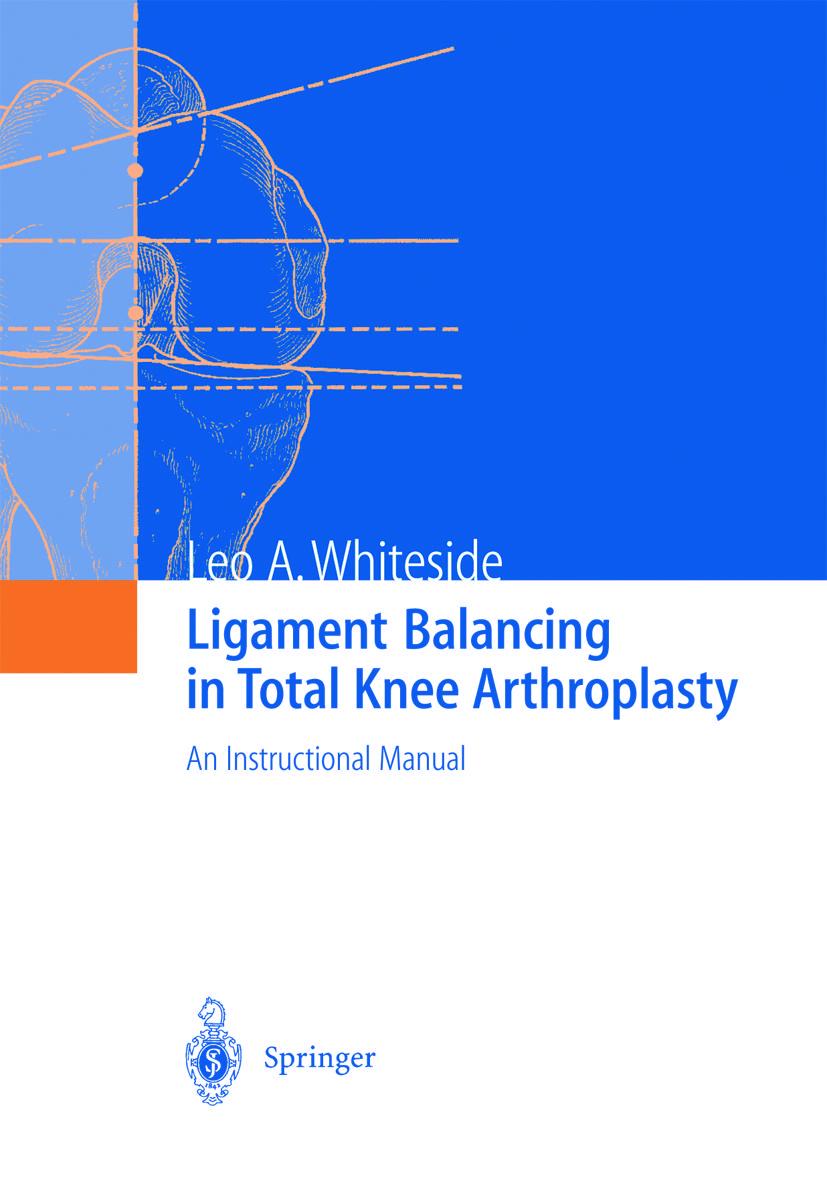 Cover: 9783642639241 | Ligament Balancing in Total Knee Arthroplasty | Leo A. Whiteside | x