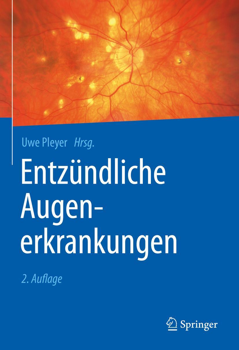 Cover: 9783662603987 | Entzündliche Augenerkrankungen | Uwe Pleyer | Buch | xxxvii | Deutsch