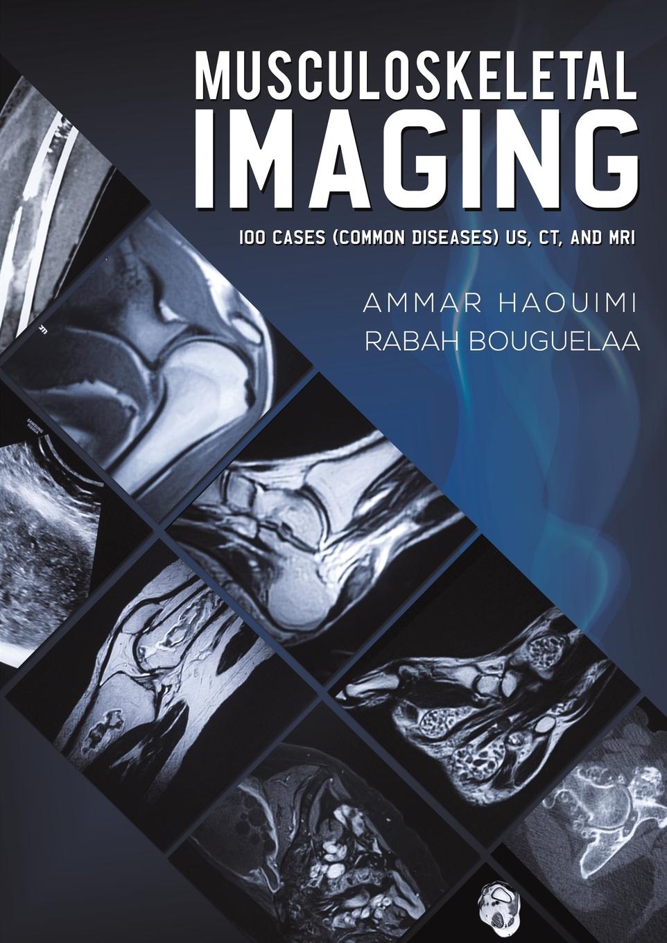 Cover: 9781528946339 | Musculoskeletal Imaging | Ammar Haouimi (u. a.) | Taschenbuch | 2021