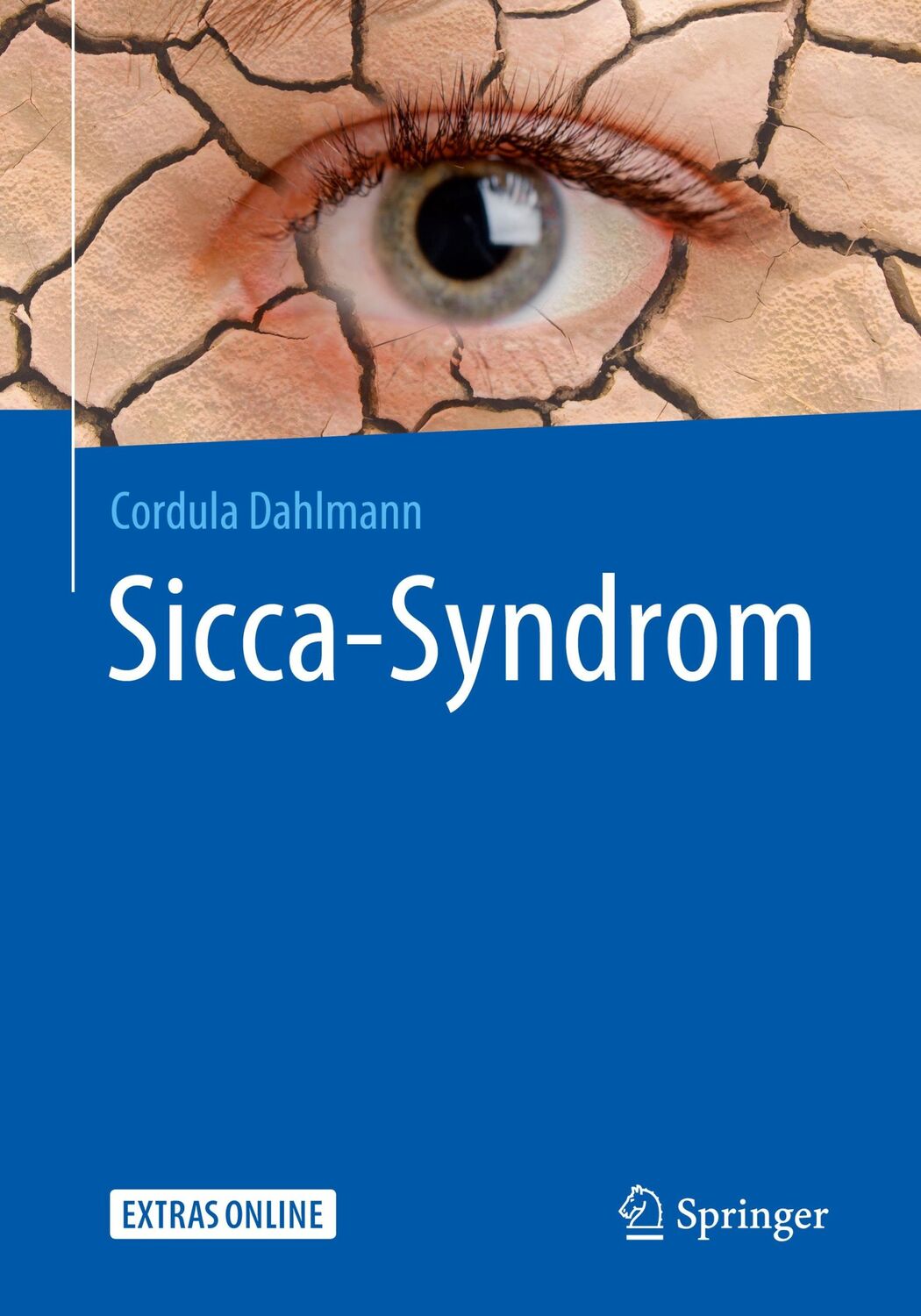 Cover: 9783662564080 | Sicca-Syndrom | Cordula Dahlmann | Taschenbuch | xiv | Deutsch | 2020