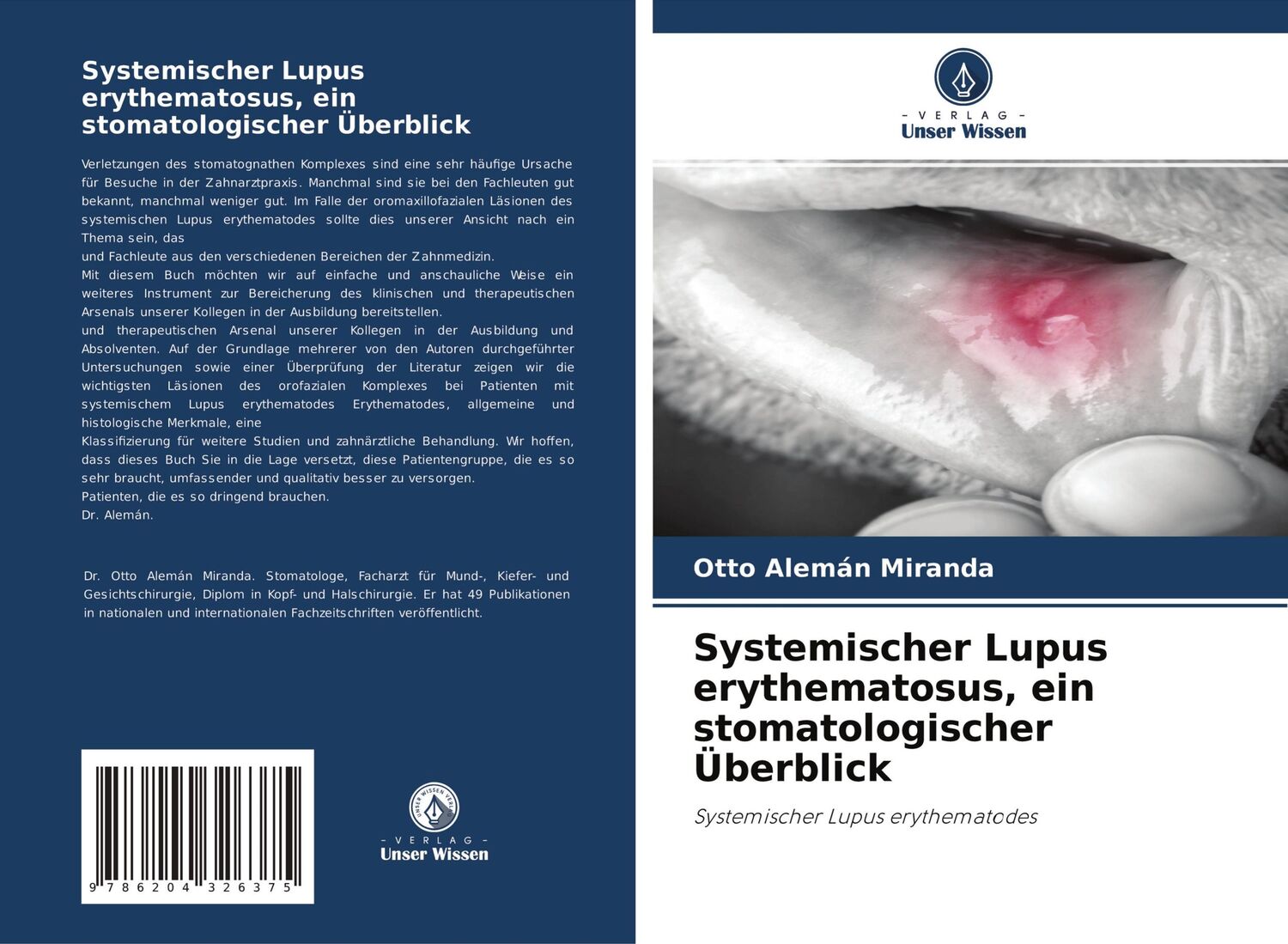 Cover: 9786204326375 | Systemischer Lupus erythematosus, ein stomatologischer Überblick