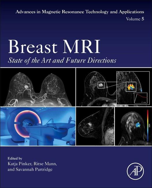 Cover: 9780128227299 | Breast MRI | State of the Art and Future Directions | Pinker (u. a.)