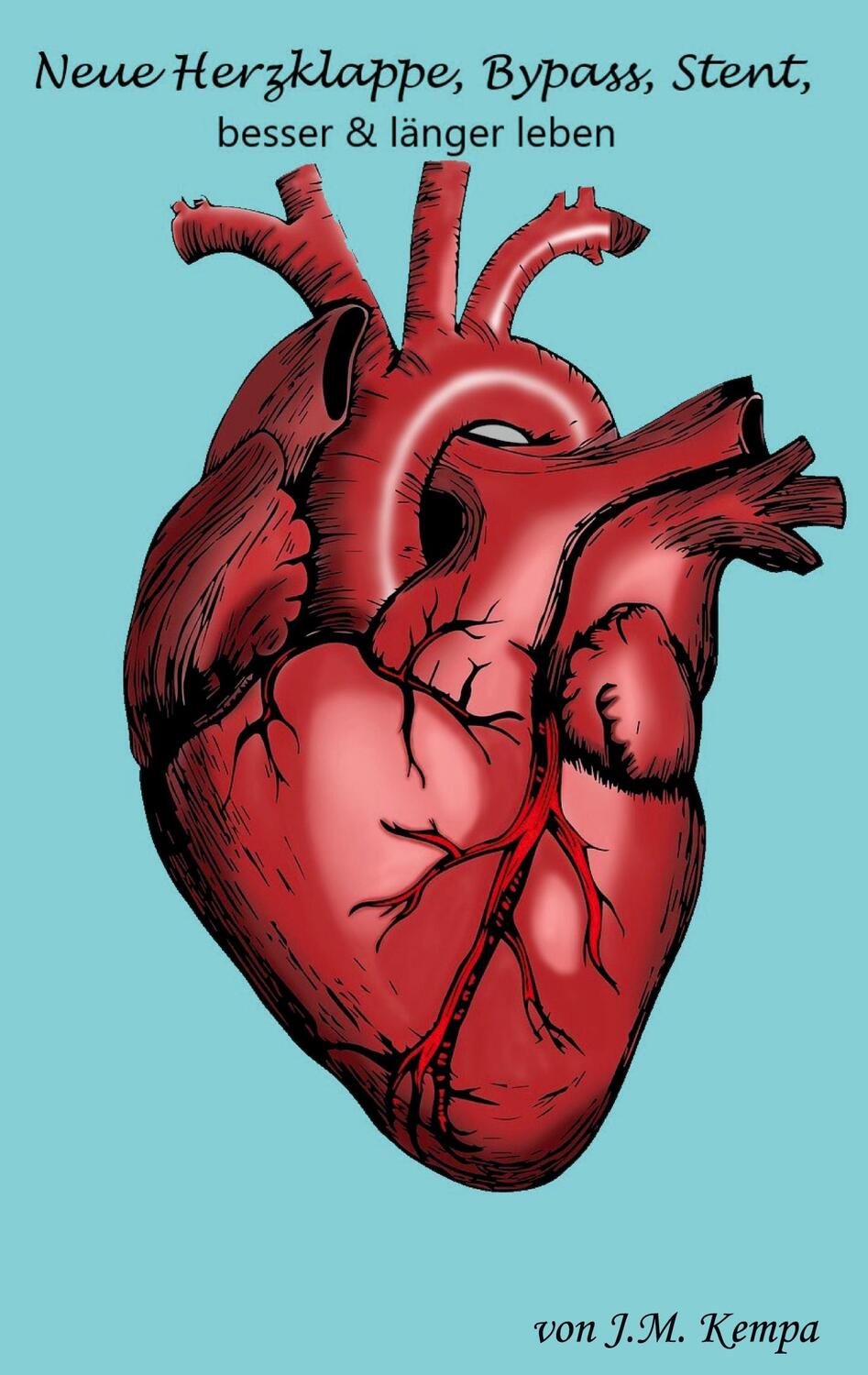 Cover: 9783988851079 | Neue Herzklappe, Bypass, Stent | Besser &amp; länger leben | J. M. Kempa