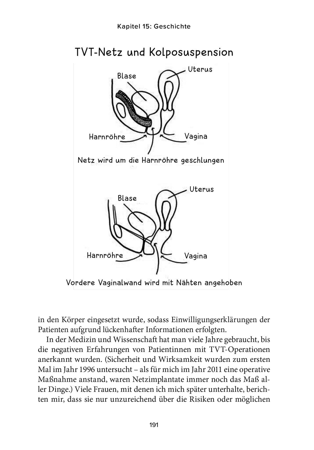 Bild: 9783867312509 | Ich bin nicht ganz dicht | Luce Brett | Taschenbuch | 368 S. | Deutsch