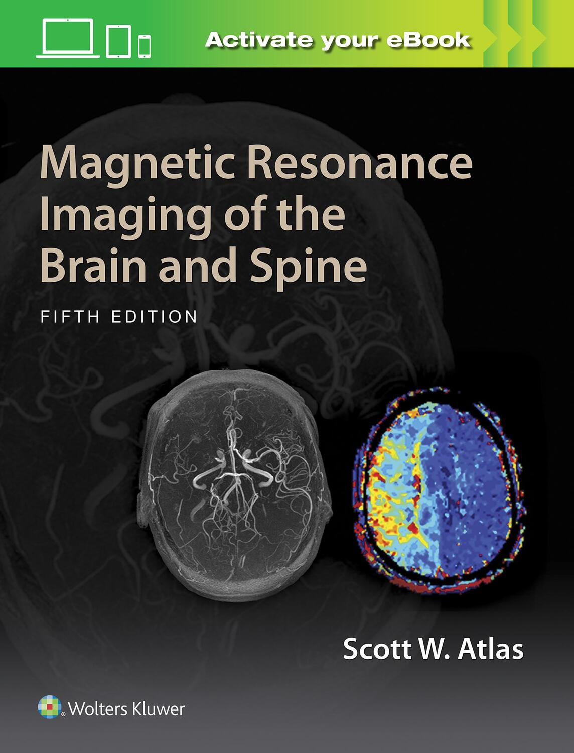 Cover: 9781469873206 | Magnetic Resonance Imaging of the Brain and Spine | Scott W. Atlas