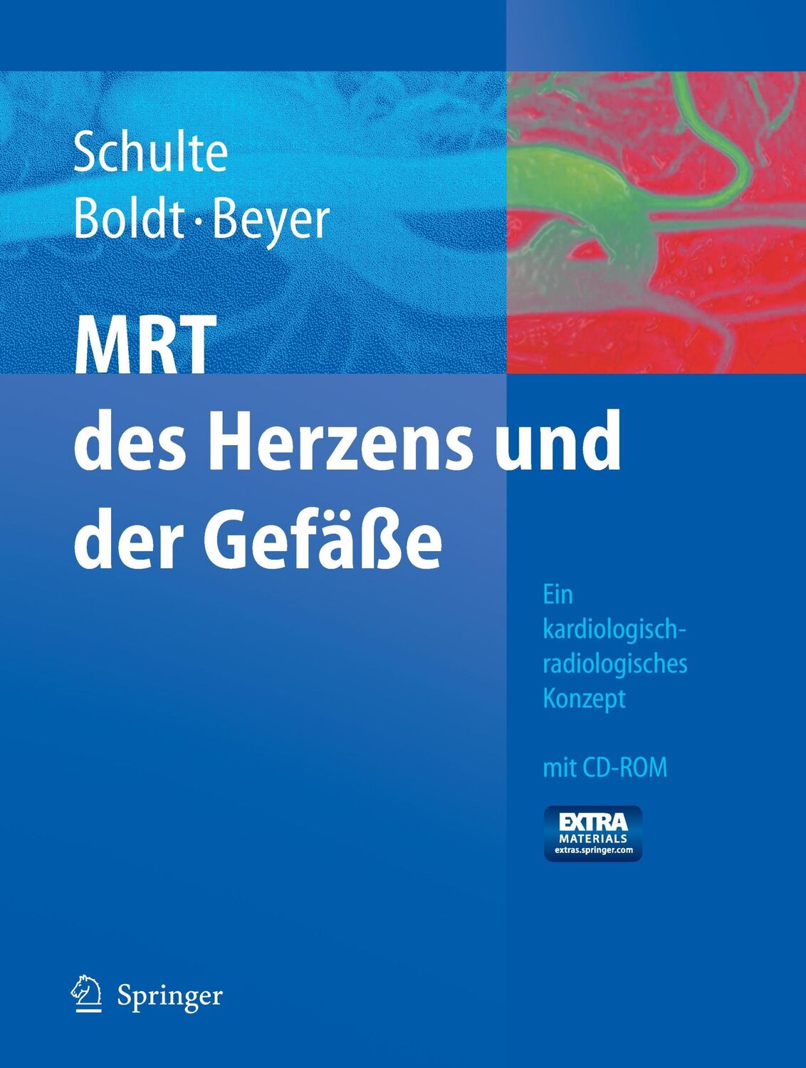 Cover: 9783540222095 | MRT des Herzens und der Gefäße | B. Schulte (u. a.) | Buch | xvii