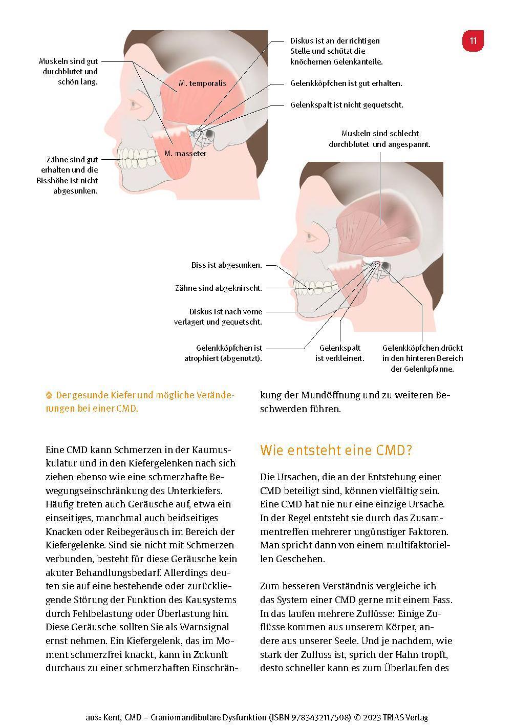 Bild: 9783432117492 | CMD - Craniomandibuläre Dysfunktion | Hamdi Kent | Taschenbuch | 2023