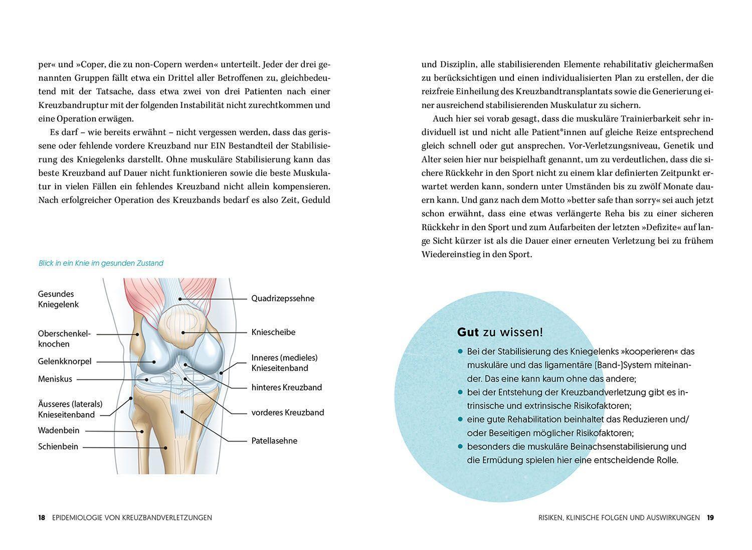 Bild: 9783968590325 | Wieder fit nach dem Kreuzbandriss | Raymond Best | Taschenbuch | 2022