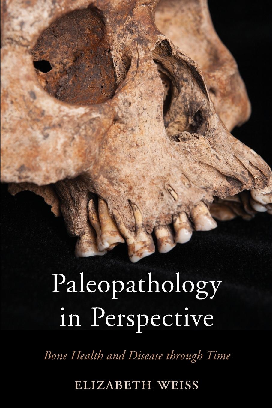 Cover: 9780759124424 | Paleopathology in Perspective | Bone Health and Disease through Time