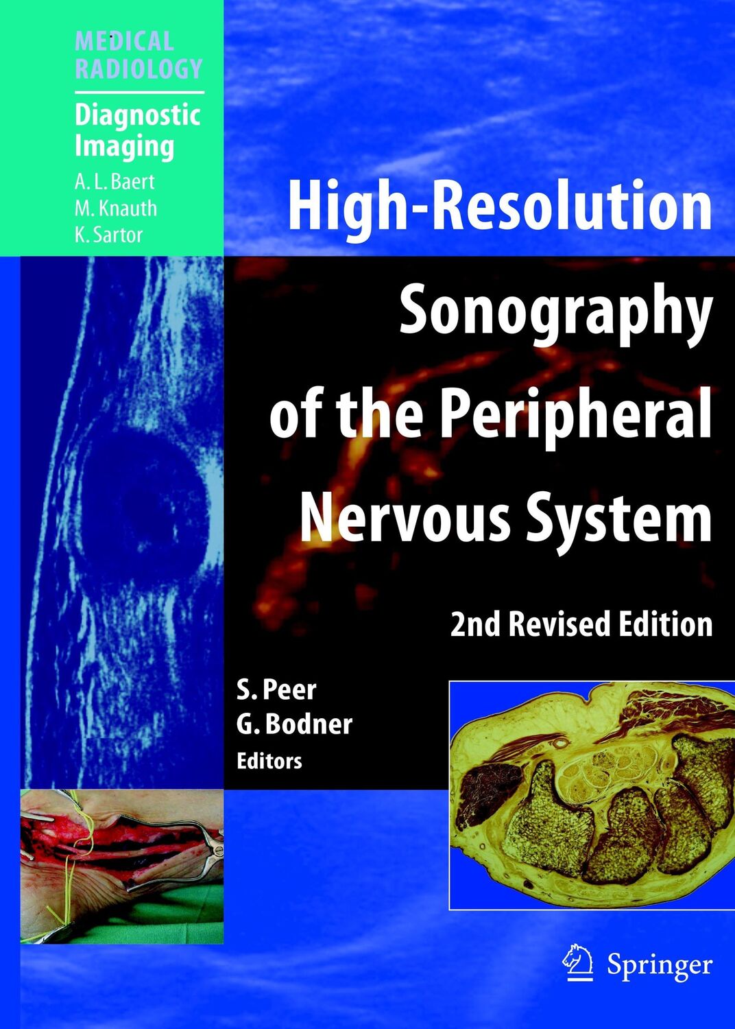 Cover: 9783642080364 | High-Resolution Sonography of the Peripheral Nervous System | Buch