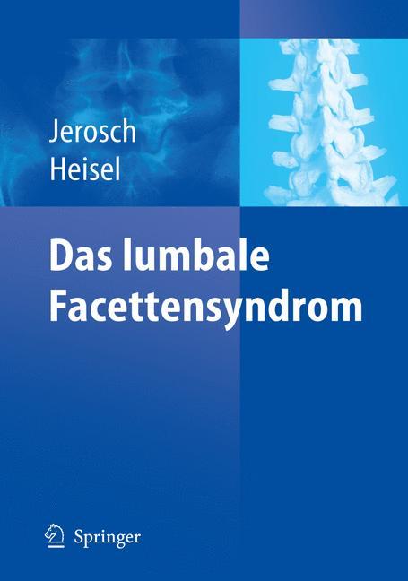 Cover: 9783540277095 | Das lumbale Facettensyndrom | Jörg Jerosch (u. a.) | Taschenbuch | x