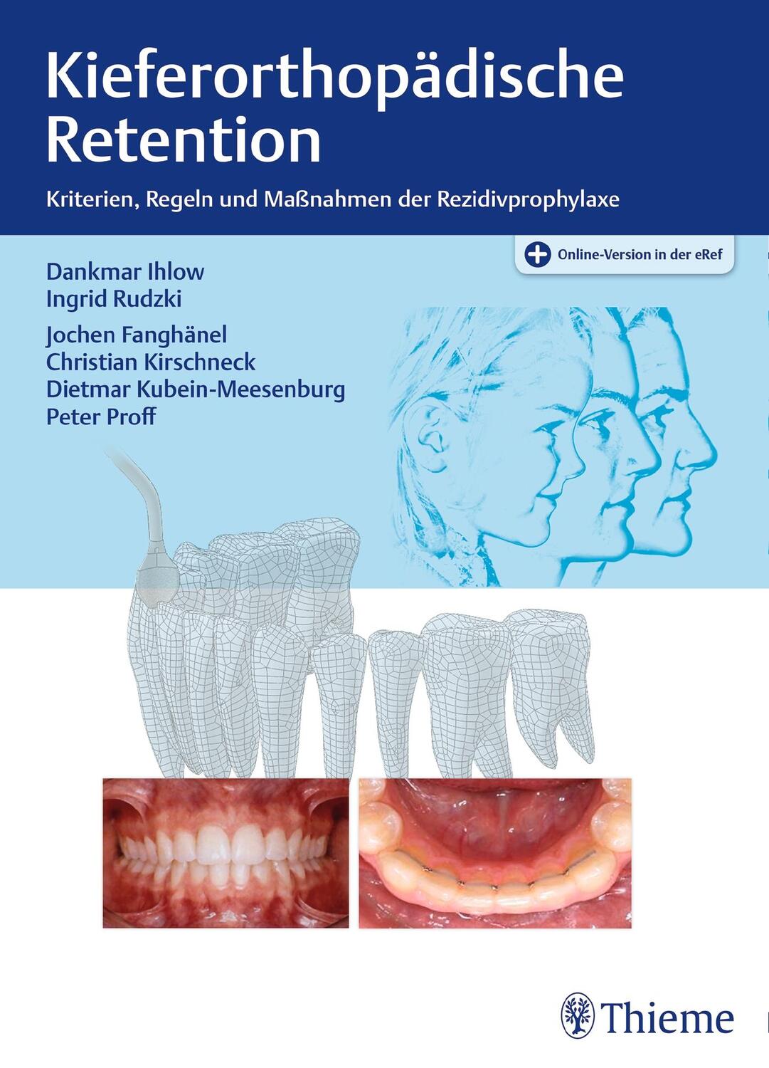 Cover: 9783131735515 | Kieferorthopädische Retention | Dankmar Ihlow (u. a.) | Bundle | 2017