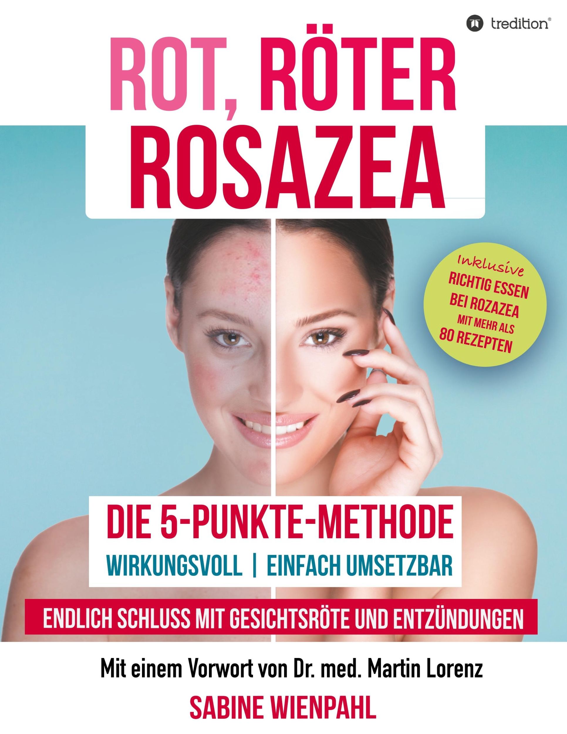 Cover: 9783746992839 | ROT RÖTER ROSAZEA | Sabine Wienpahl | Taschenbuch | Paperback | 236 S.