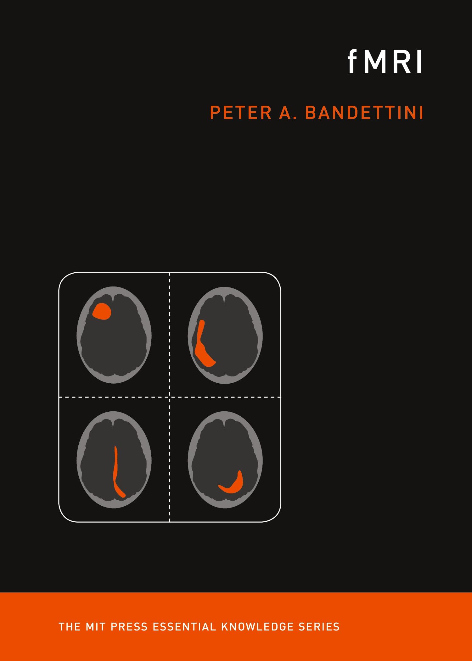 Cover: 9780262538039 | fMRI | Peter A. Bandettini | Taschenbuch | Einband - flex.(Paperback)